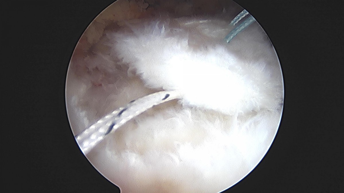 3cd48a8e02e388456e21d82dd041ccef_1652069175_6645.jpg