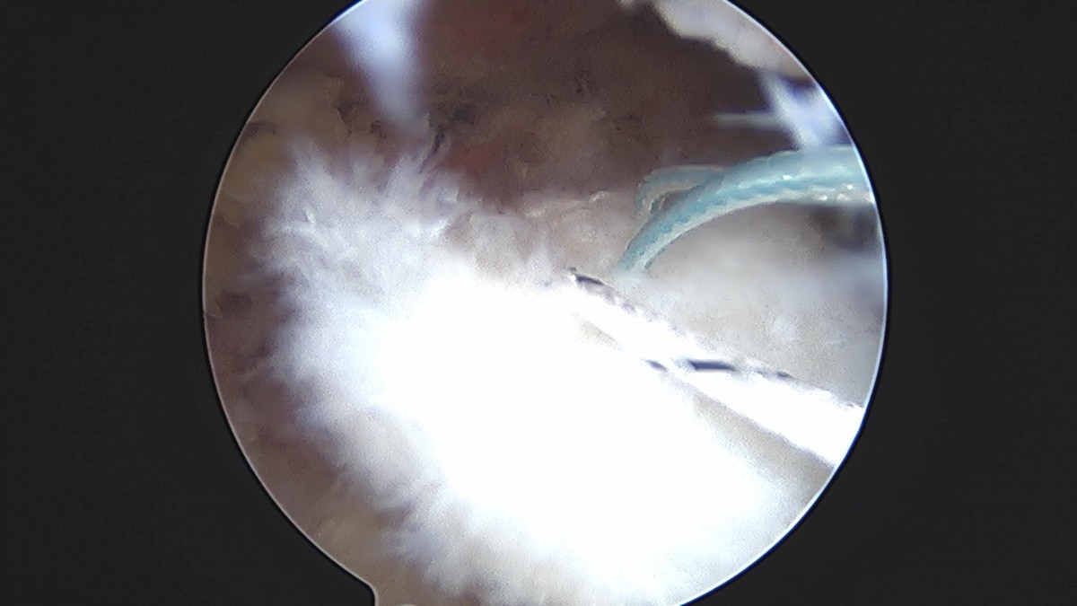 3cd48a8e02e388456e21d82dd041ccef_1652069176_3515.jpg