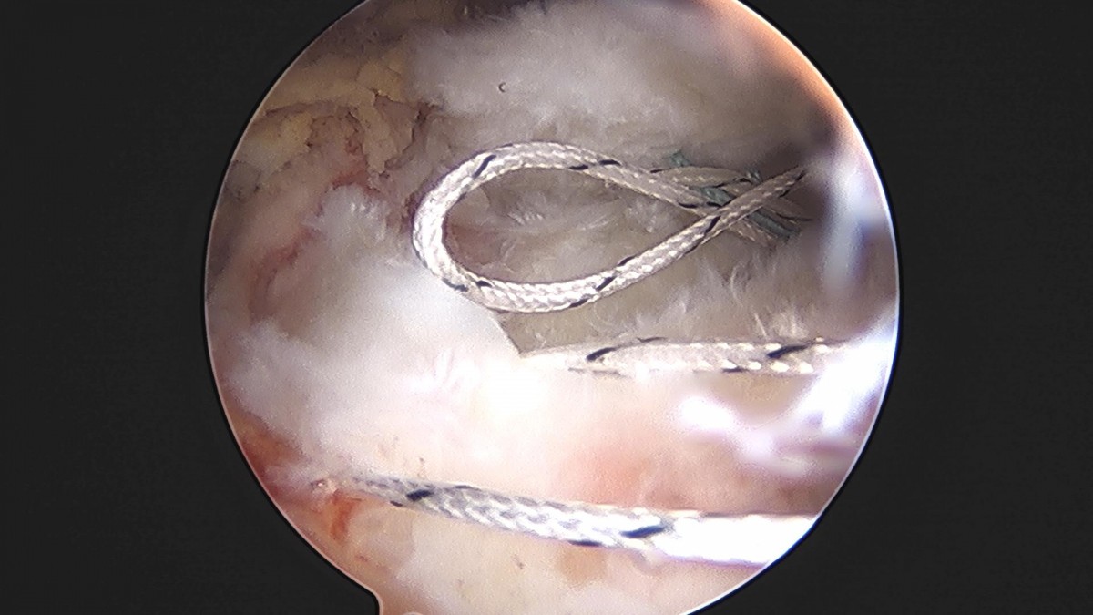 3cd48a8e02e388456e21d82dd041ccef_1652069177_0109.jpg