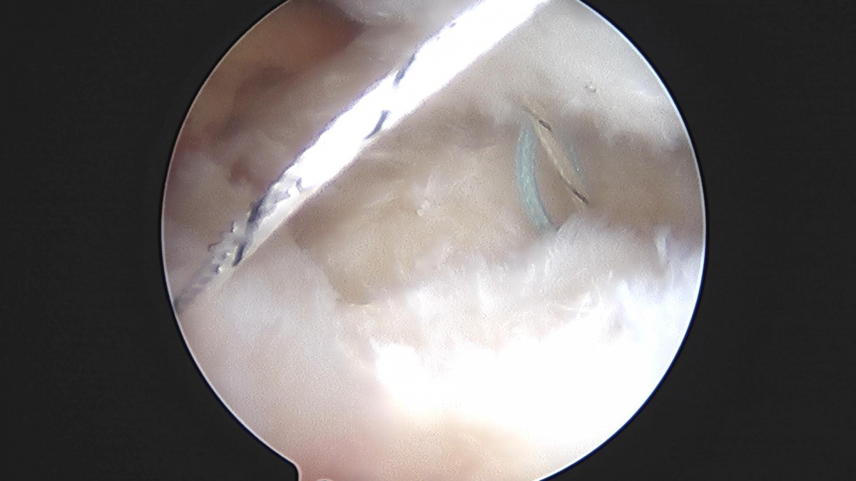 3cd48a8e02e388456e21d82dd041ccef_1652069177_6432.jpg