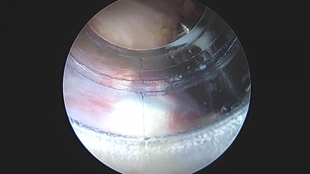 3cd48a8e02e388456e21d82dd041ccef_1652069269_5531.jpg