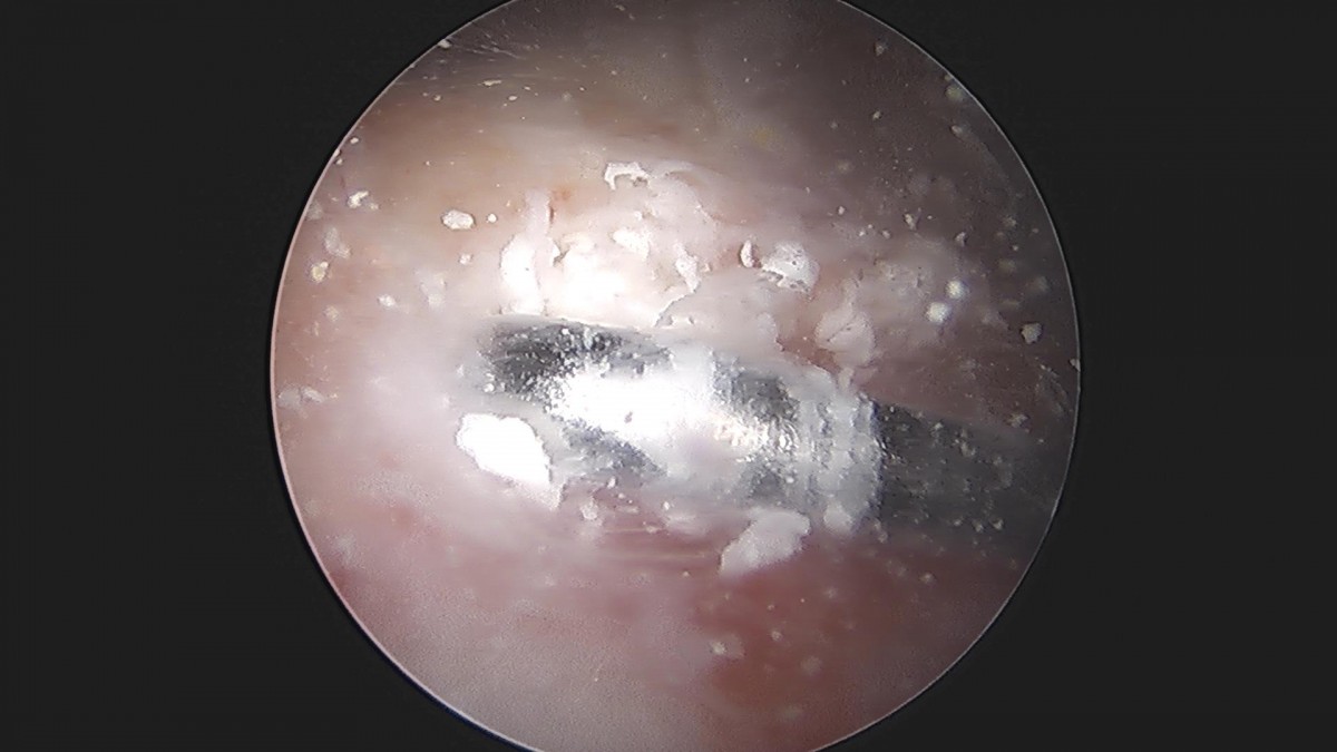 3cd48a8e02e388456e21d82dd041ccef_1652069280_4544.jpg