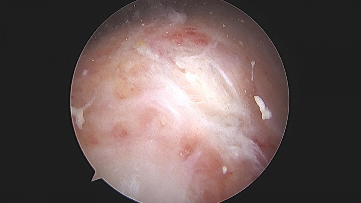 3cd48a8e02e388456e21d82dd041ccef_1652069282_6148.jpg