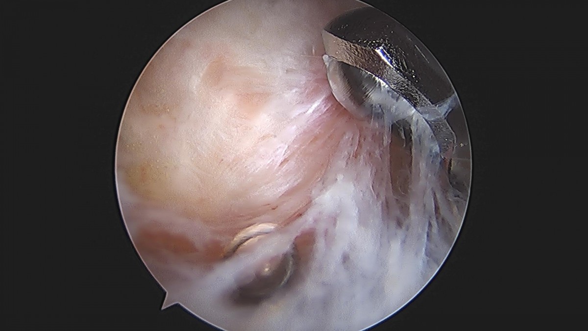 3cd48a8e02e388456e21d82dd041ccef_1652069283_9684.jpg