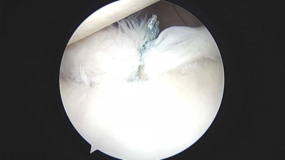 9bd32f36aa7dff884b615e35b18923ca_1657596201_6531.jpg