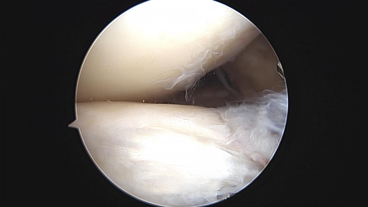 3d4f27b63eab0959db34cd7061cf6e91_1661153290_0673.jpg