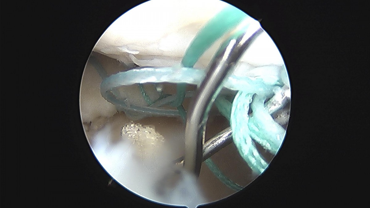 3d4f27b63eab0959db34cd7061cf6e91_1661153592_6911.jpg