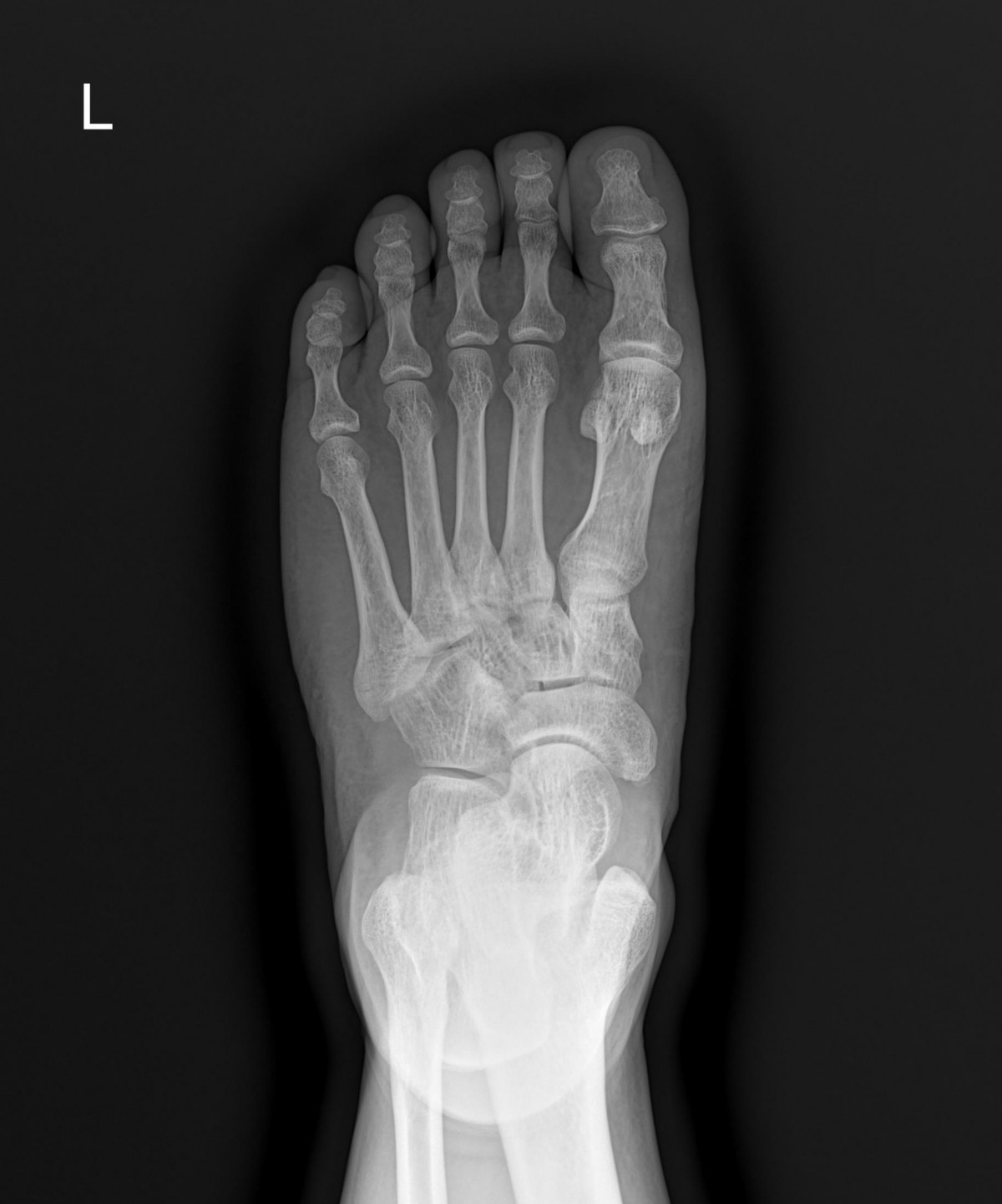 3d4f27b63eab0959db34cd7061cf6e91_1661154610_3442.jpg