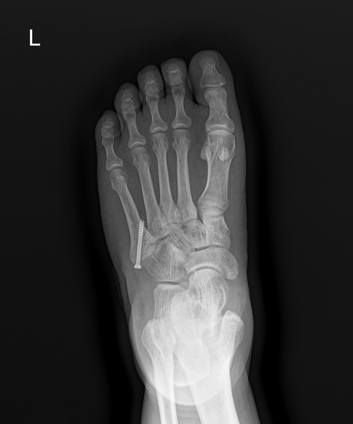 3d4f27b63eab0959db34cd7061cf6e91_1661154622_6226.jpg
