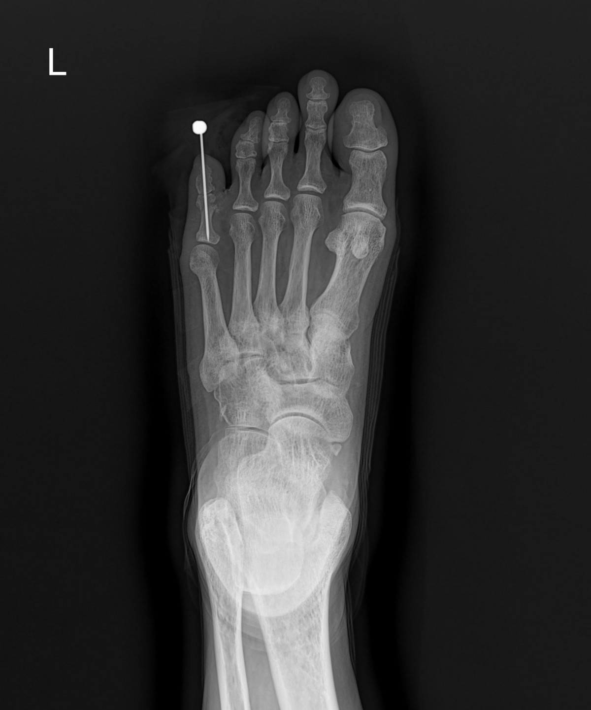 3d4f27b63eab0959db34cd7061cf6e91_1661155397_6934.jpg