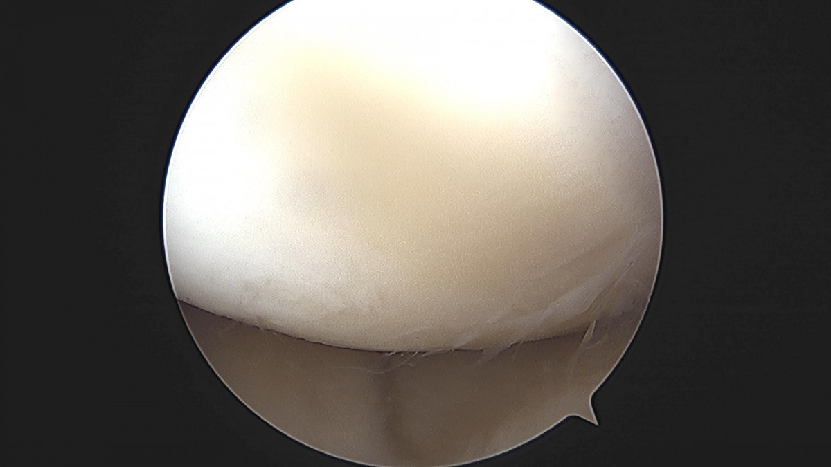 3d4f27b63eab0959db34cd7061cf6e91_1661155734_1576.jpg