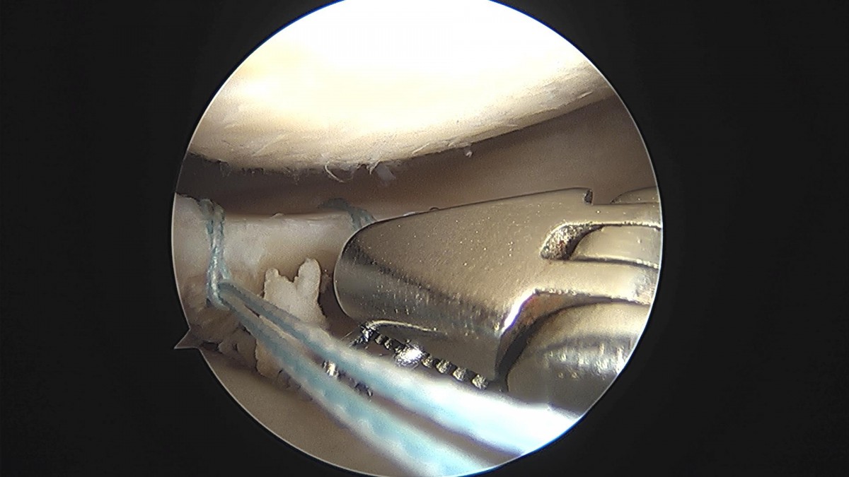 bccafb0c4c611c3a9fcb6ca752df8d40_1670487055_1052.jpg