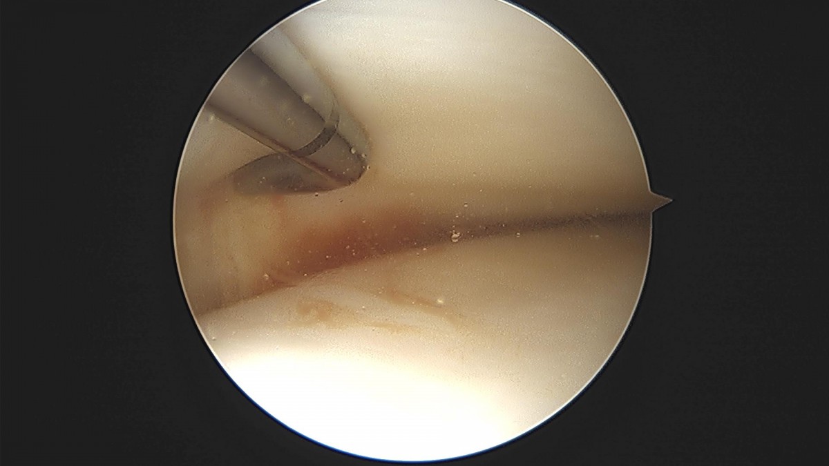 bccafb0c4c611c3a9fcb6ca752df8d40_1670487278_6383.jpg