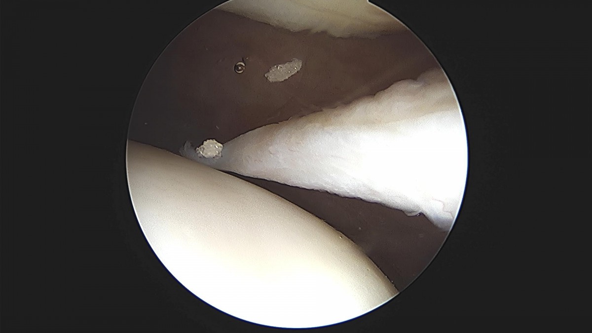 bccafb0c4c611c3a9fcb6ca752df8d40_1670487535_5294.jpg