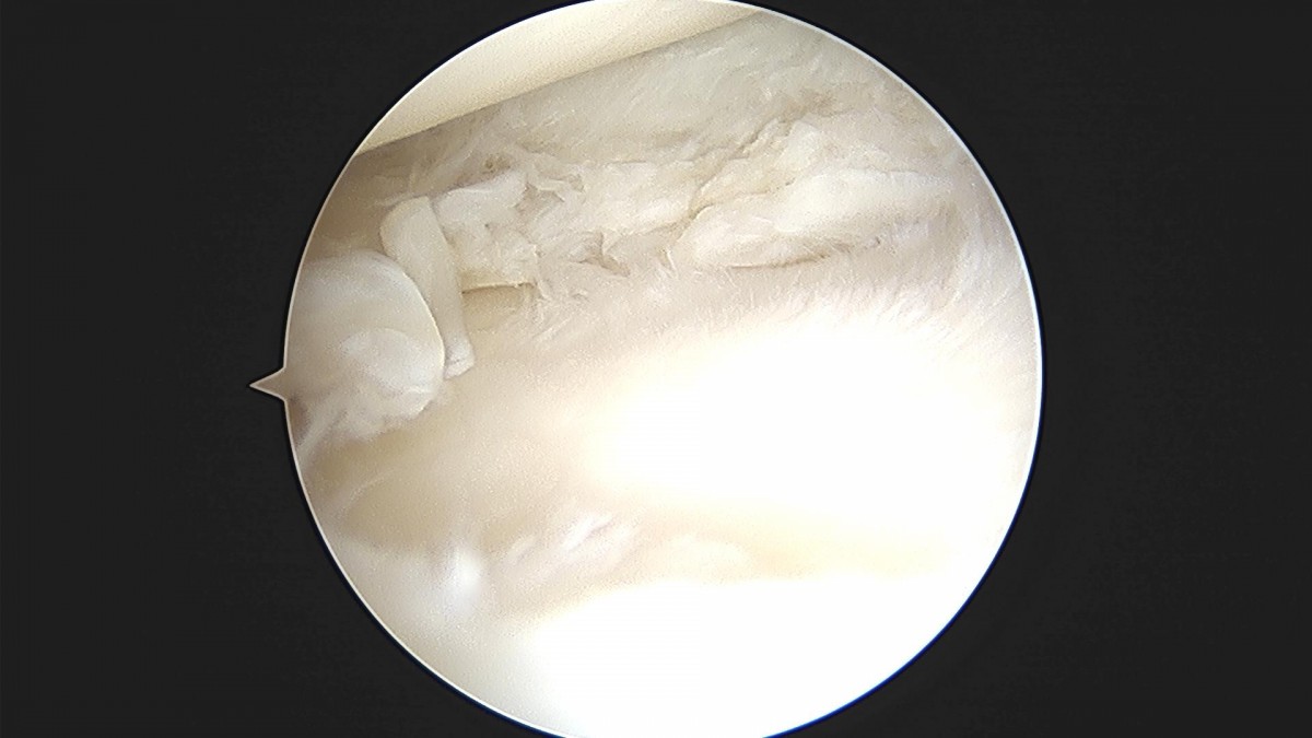 bccafb0c4c611c3a9fcb6ca752df8d40_1670487551_5748.jpg