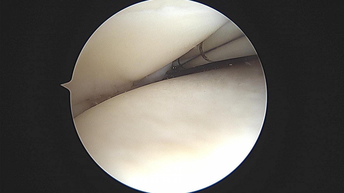 bccafb0c4c611c3a9fcb6ca752df8d40_1670487626_5102.jpg