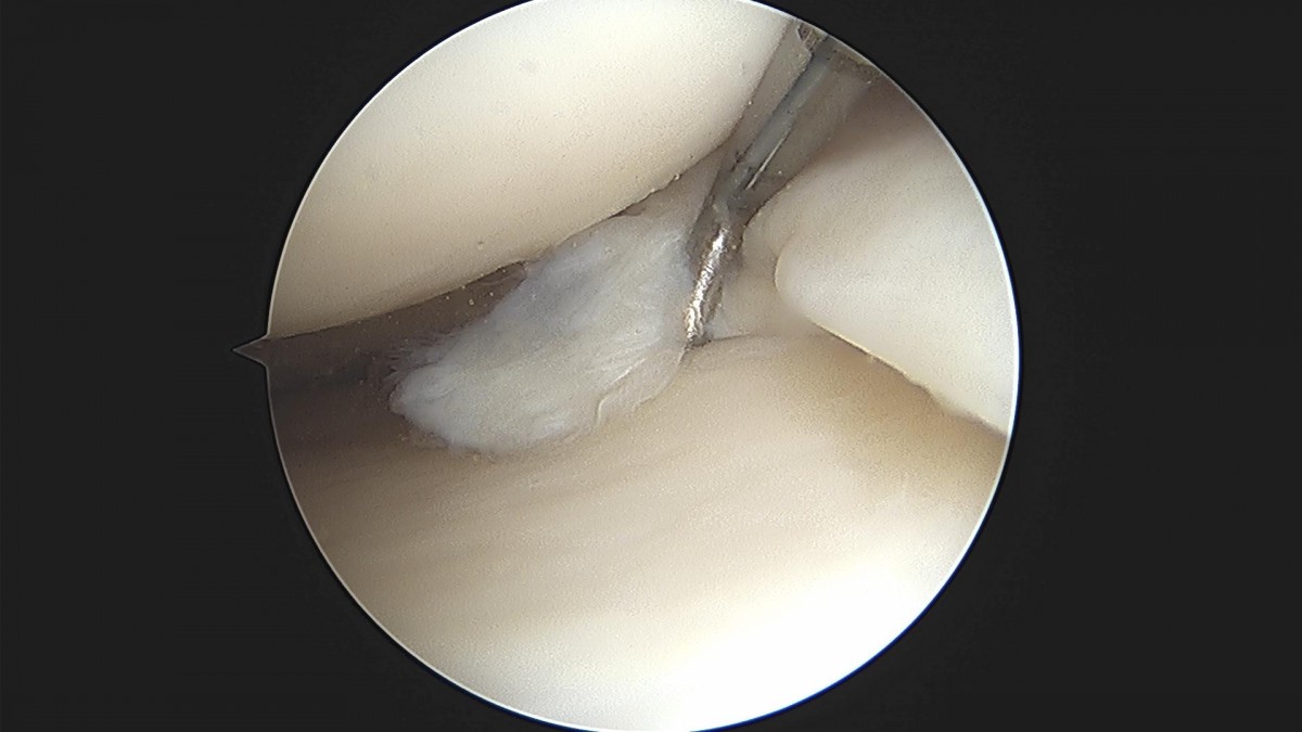 bccafb0c4c611c3a9fcb6ca752df8d40_1670488060_5496.jpg