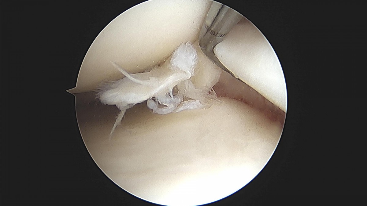 bccafb0c4c611c3a9fcb6ca752df8d40_1670488061_2336.jpg