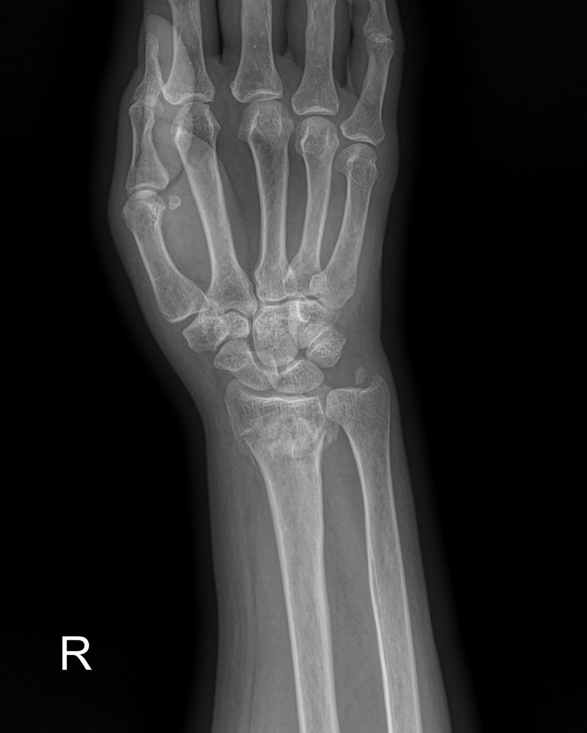 ade708f6ffdfd2e6dcf188e7ecb45ff3_1673510059_6618.jpg