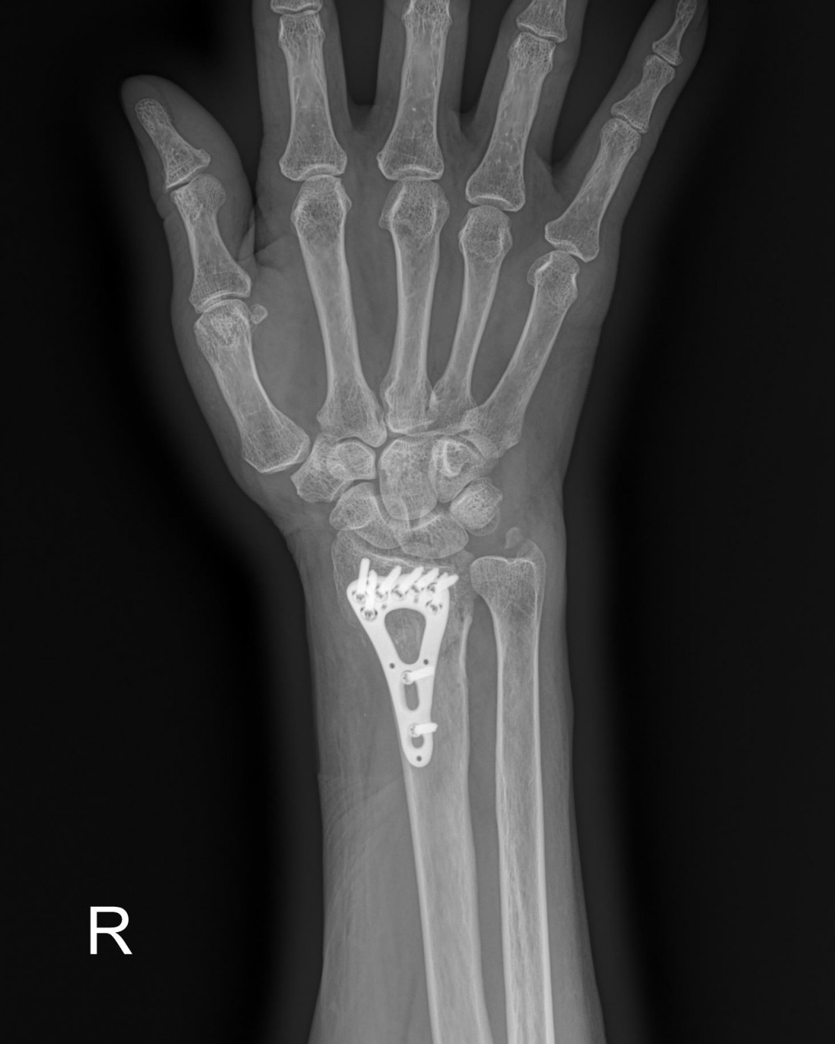 ade708f6ffdfd2e6dcf188e7ecb45ff3_1673510073_009.jpg