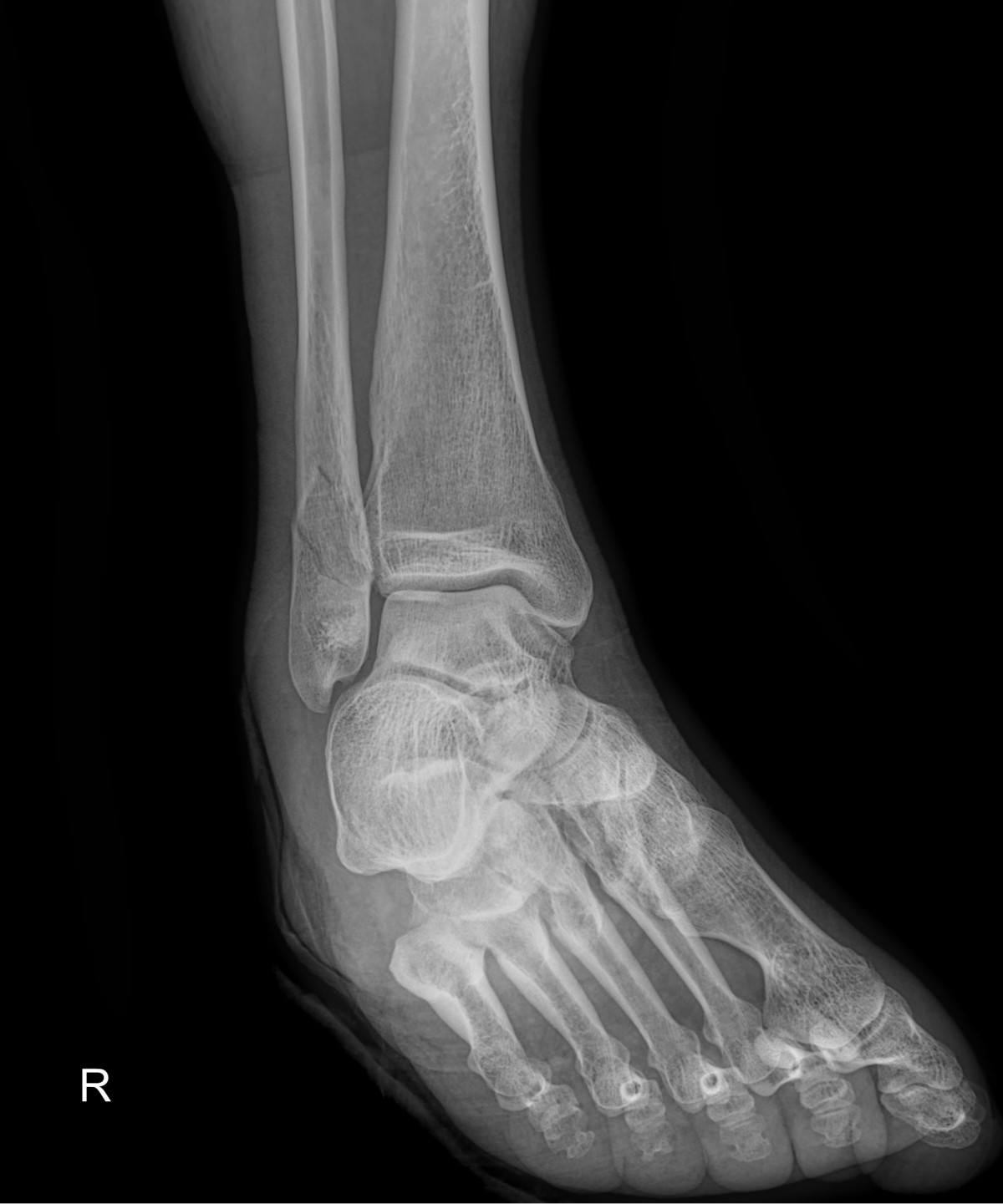 ade708f6ffdfd2e6dcf188e7ecb45ff3_1673510402_7218.jpg