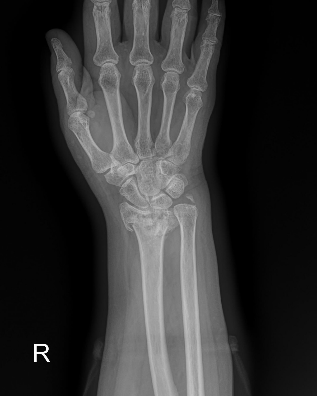 ade708f6ffdfd2e6dcf188e7ecb45ff3_1673510474_1937.jpg