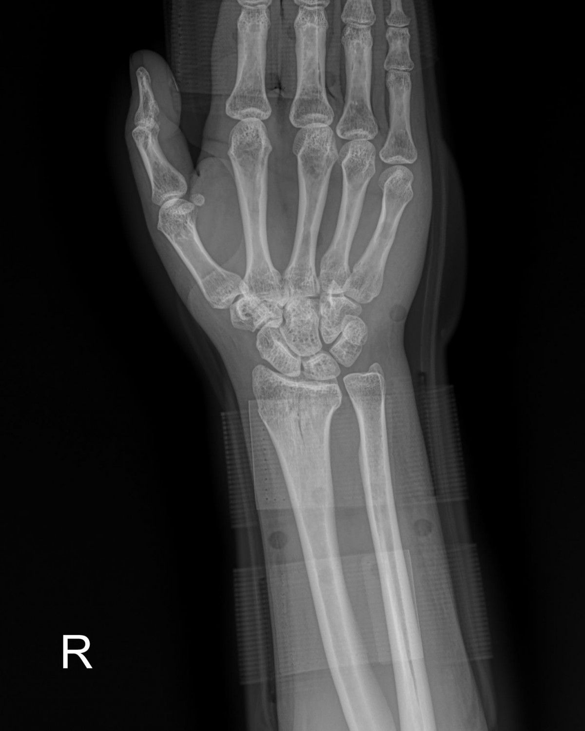 ade708f6ffdfd2e6dcf188e7ecb45ff3_1673510571_0262.jpg