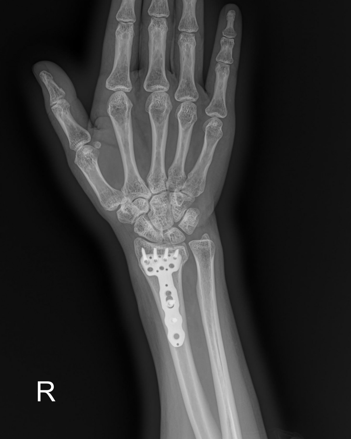 ade708f6ffdfd2e6dcf188e7ecb45ff3_1673510583_515.jpg