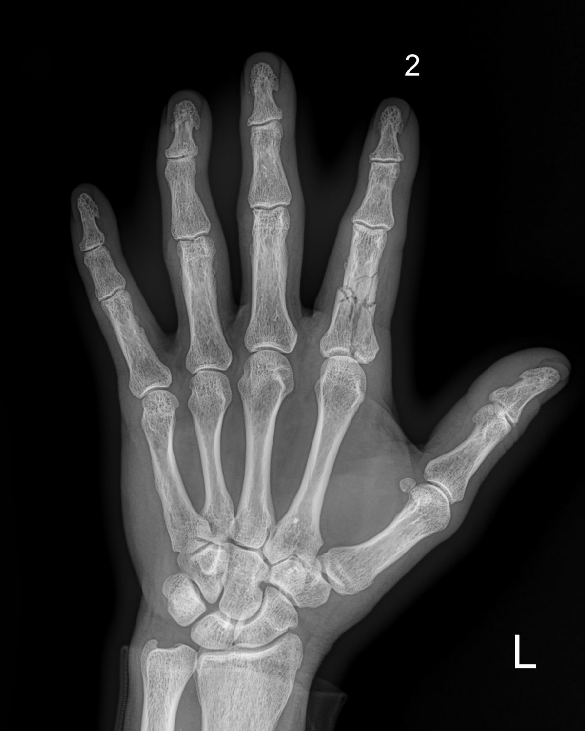 ade708f6ffdfd2e6dcf188e7ecb45ff3_1673511004_0996.jpg