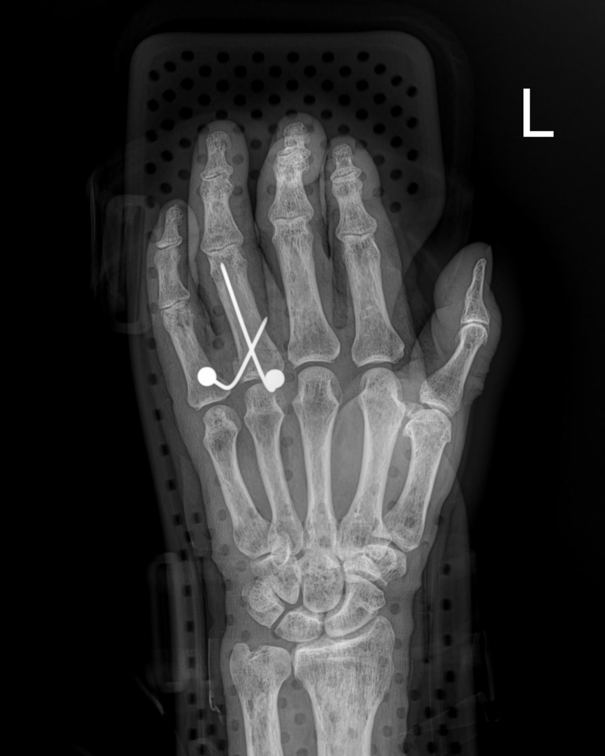 ade708f6ffdfd2e6dcf188e7ecb45ff3_1673511220_2001.jpg