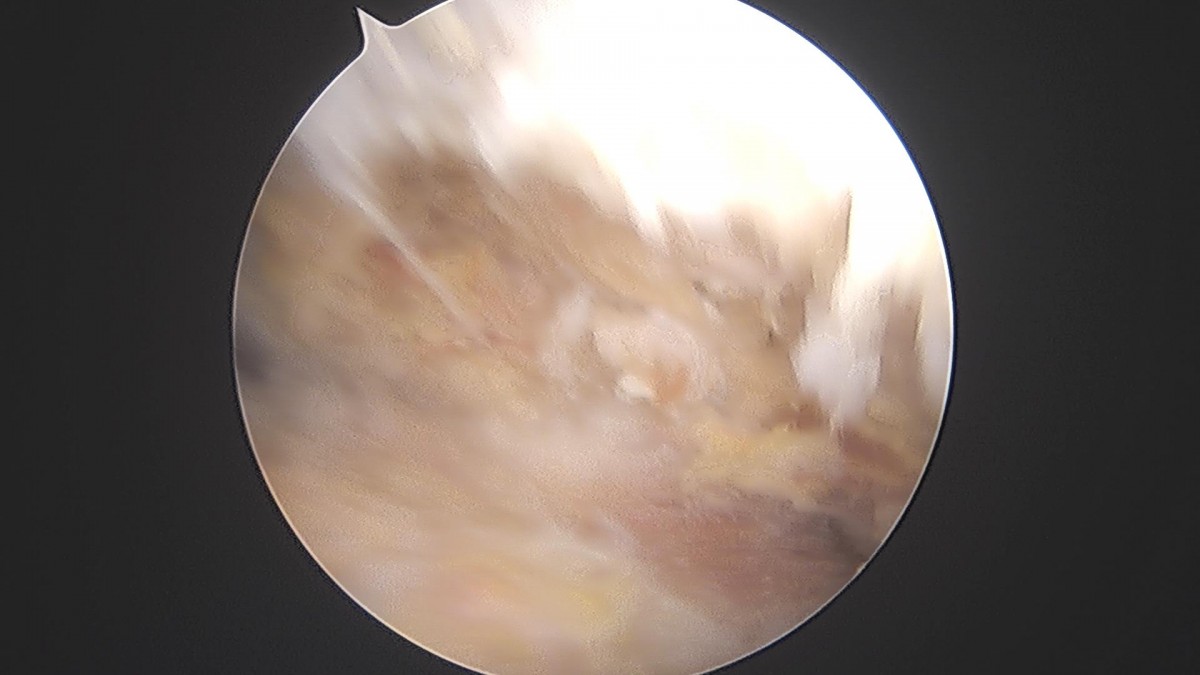 ade708f6ffdfd2e6dcf188e7ecb45ff3_1673513210_28.jpg