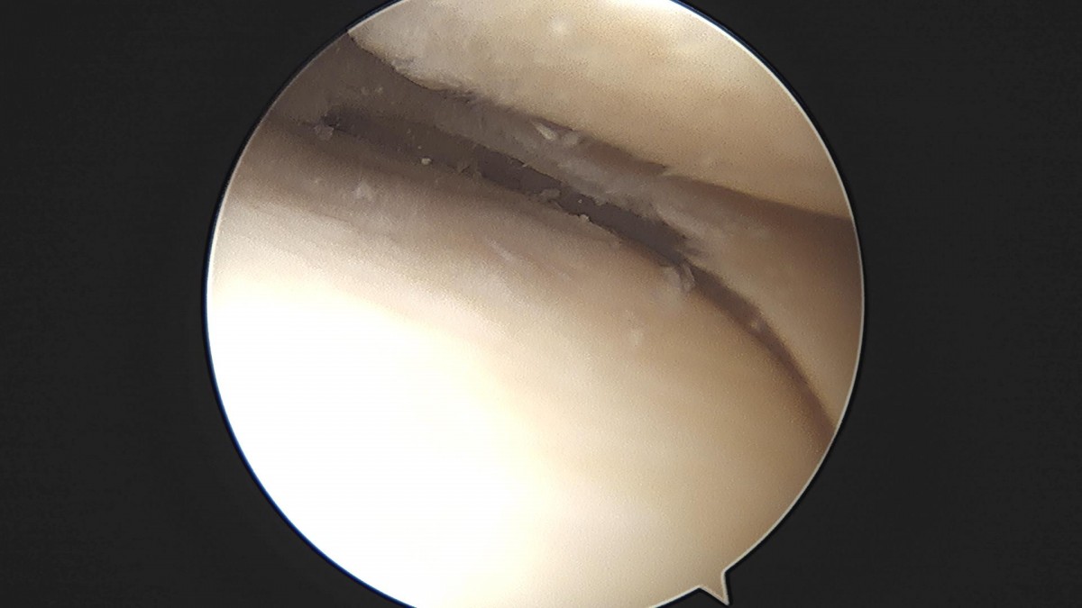 ade708f6ffdfd2e6dcf188e7ecb45ff3_1673513654_4602.jpg