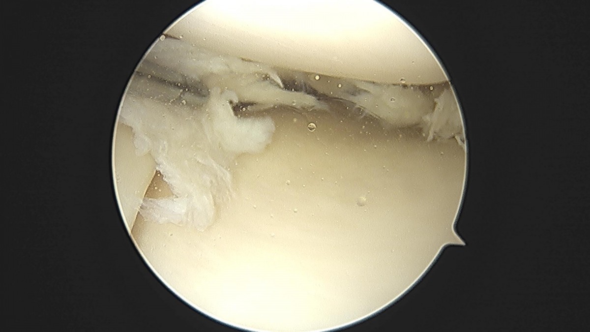 ade708f6ffdfd2e6dcf188e7ecb45ff3_1673513877_874.jpg