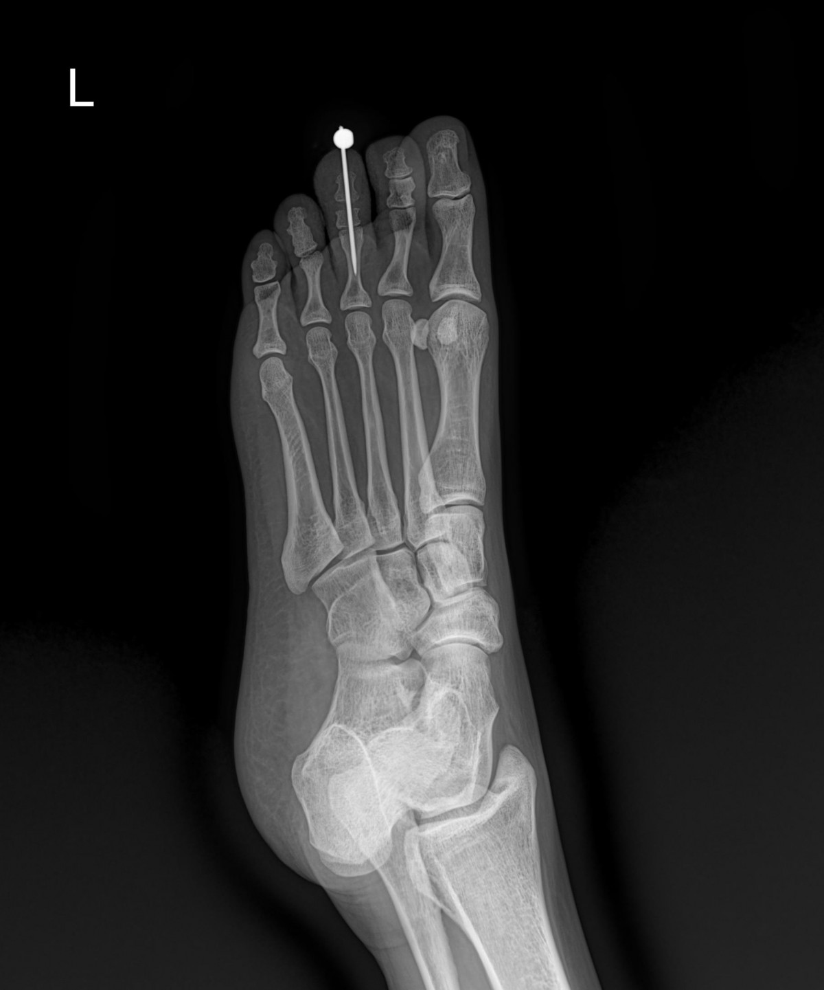 916473fabde5177f9167192daa4ca201_1676338720_9104.jpg
