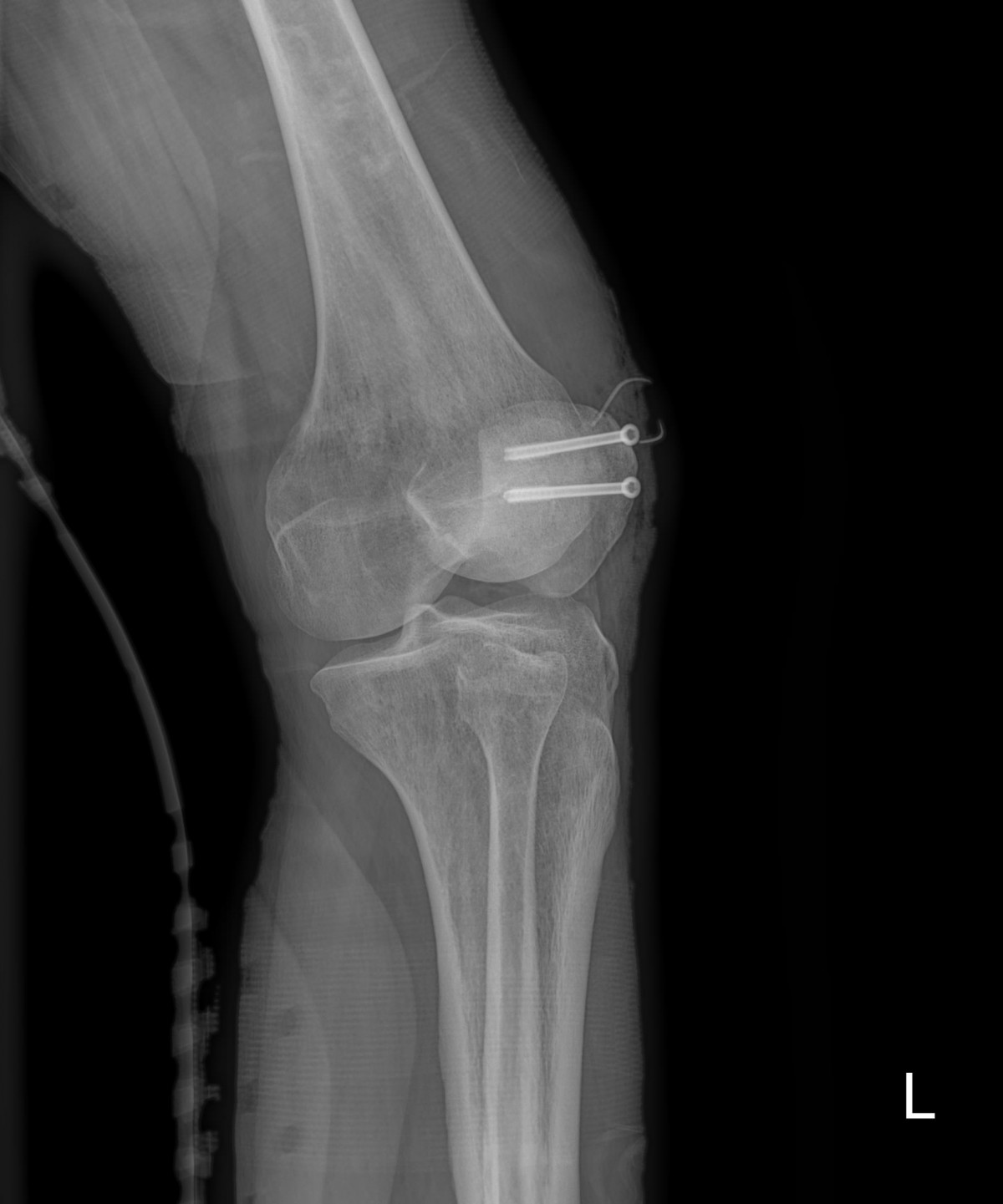 916473fabde5177f9167192daa4ca201_1676340092_9221.jpg
