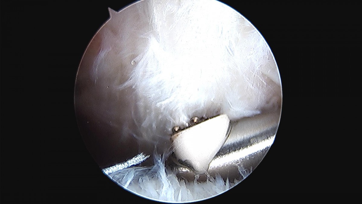 916473fabde5177f9167192daa4ca201_1676340451_8624.jpg