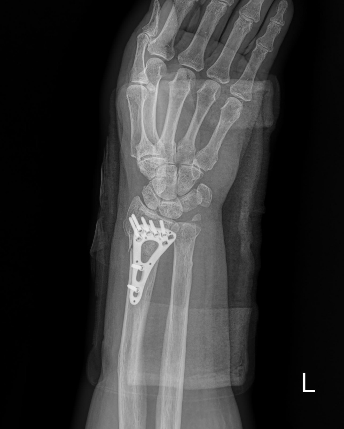 916473fabde5177f9167192daa4ca201_1676341311_4129.jpg