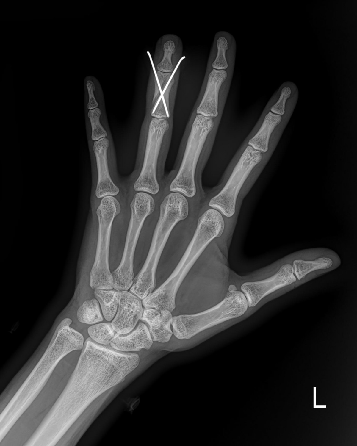 916473fabde5177f9167192daa4ca201_1676341374_4633.jpg