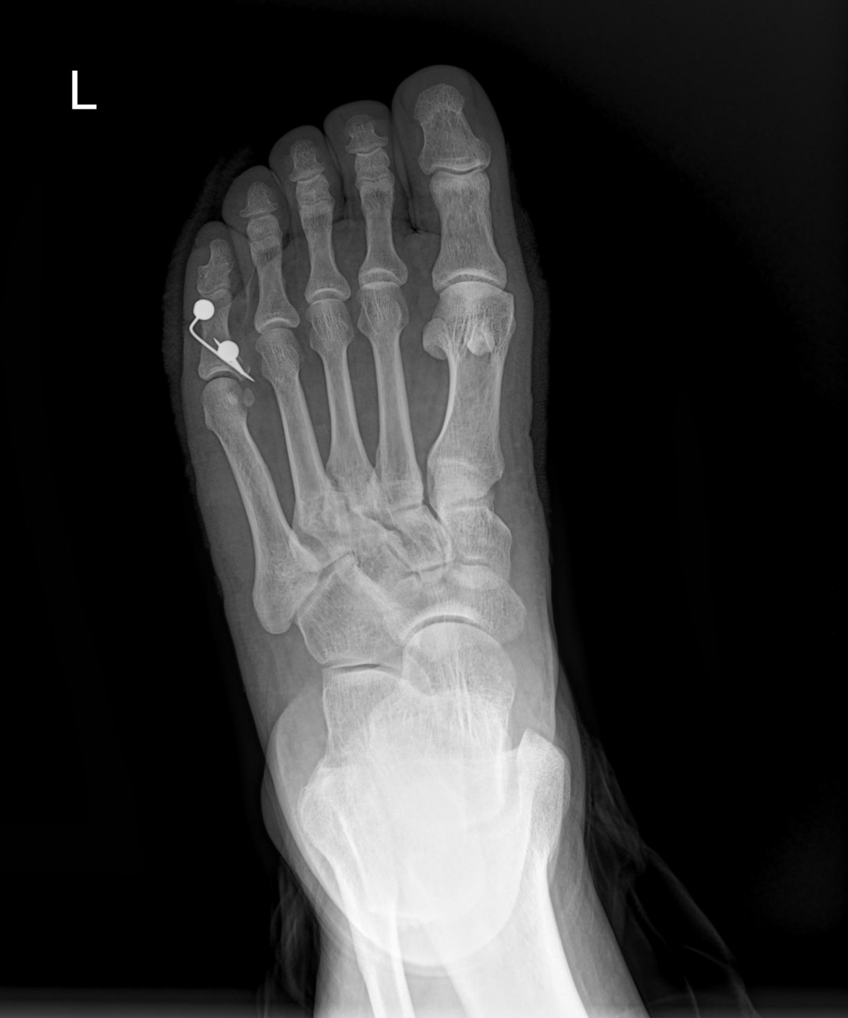 916473fabde5177f9167192daa4ca201_1676341665_3208.jpg