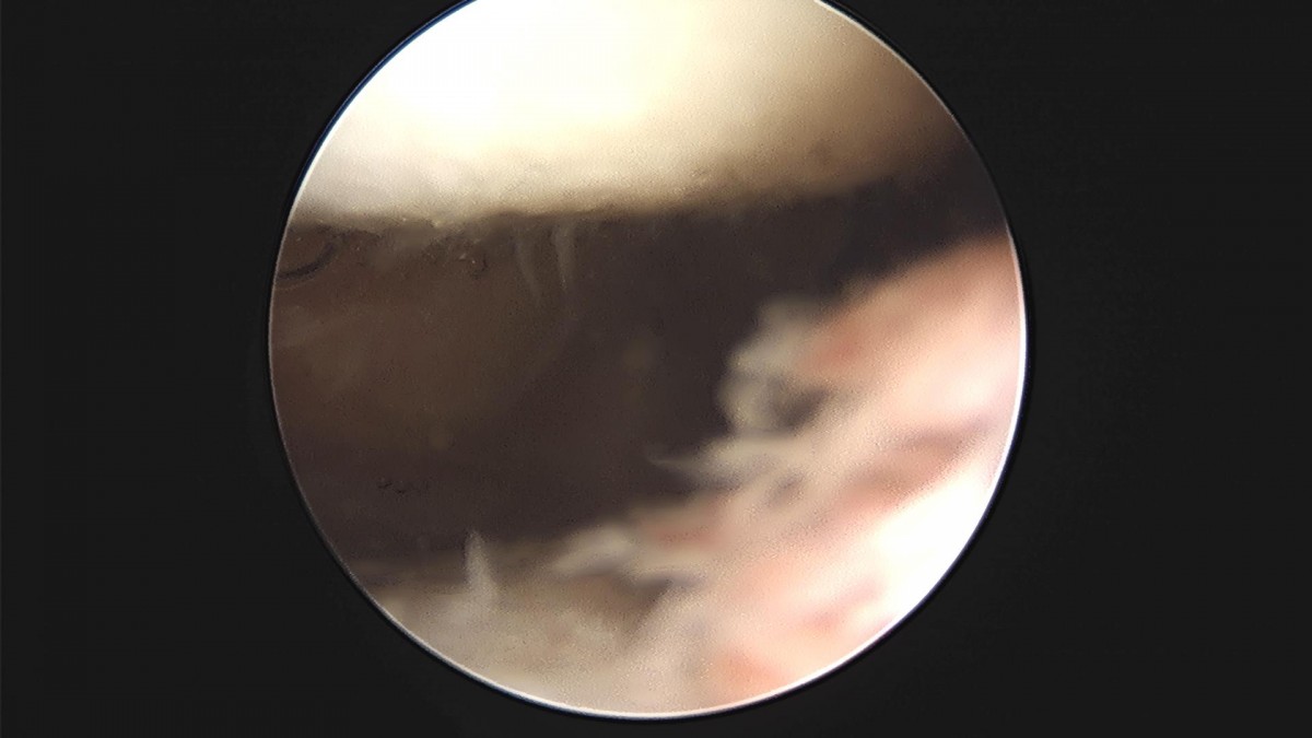 c216224544a9acae255fe16a0ae5549d_1693984958_0953.jpg