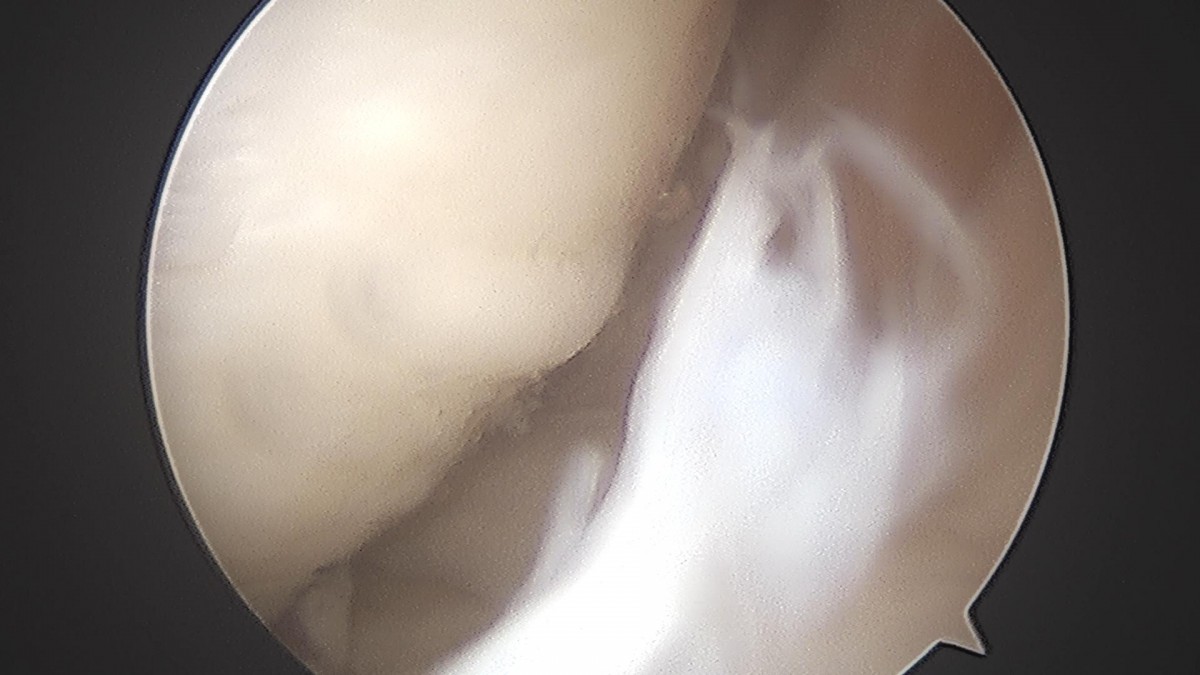c216224544a9acae255fe16a0ae5549d_1693985039_6464.jpg