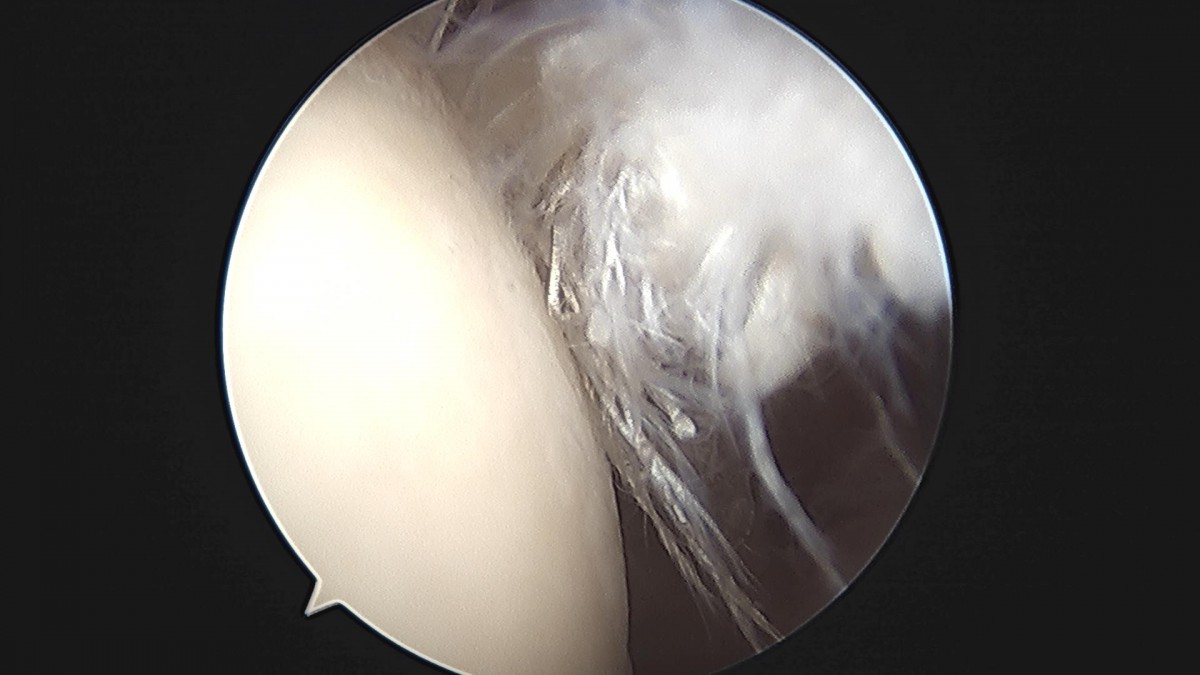 c216224544a9acae255fe16a0ae5549d_1693985912_5444.jpg