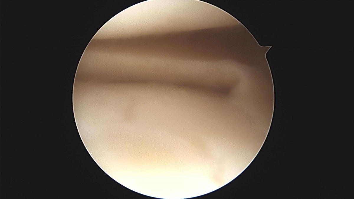 c216224544a9acae255fe16a0ae5549d_1693985999_6358.jpg