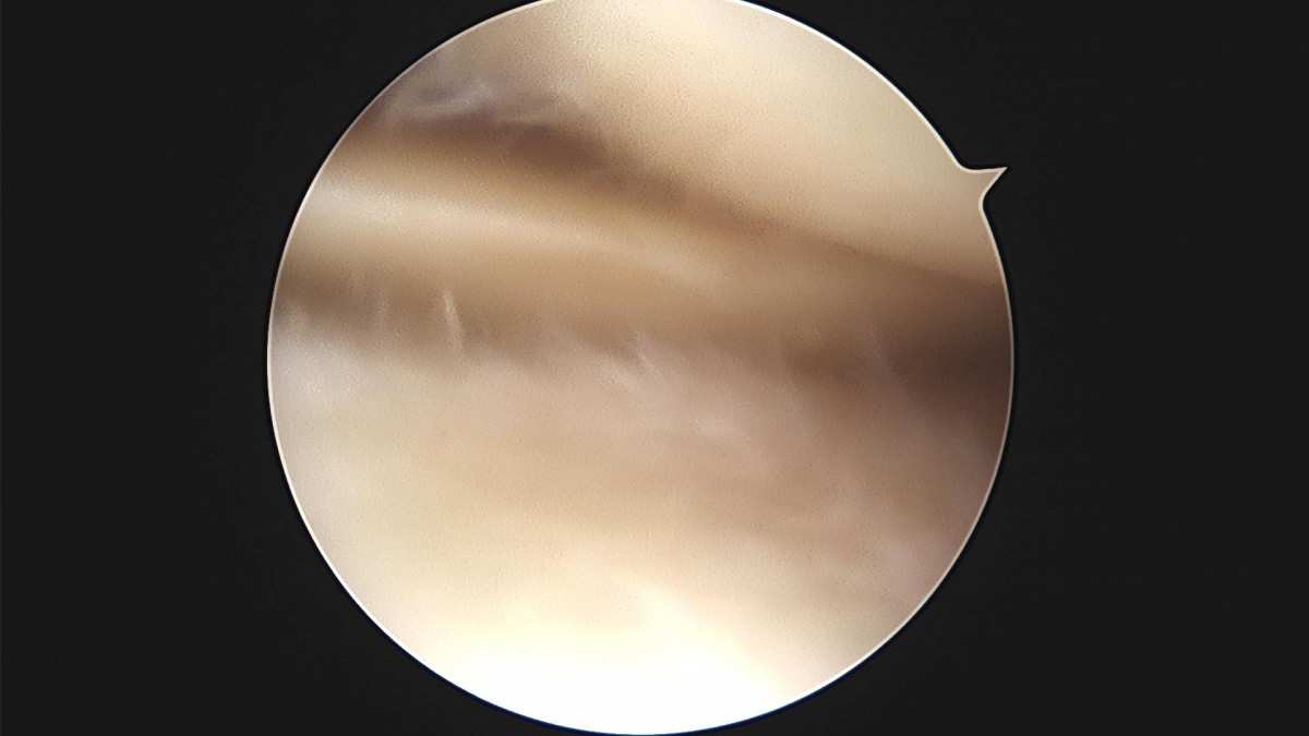 c216224544a9acae255fe16a0ae5549d_1693985999_7775.jpg