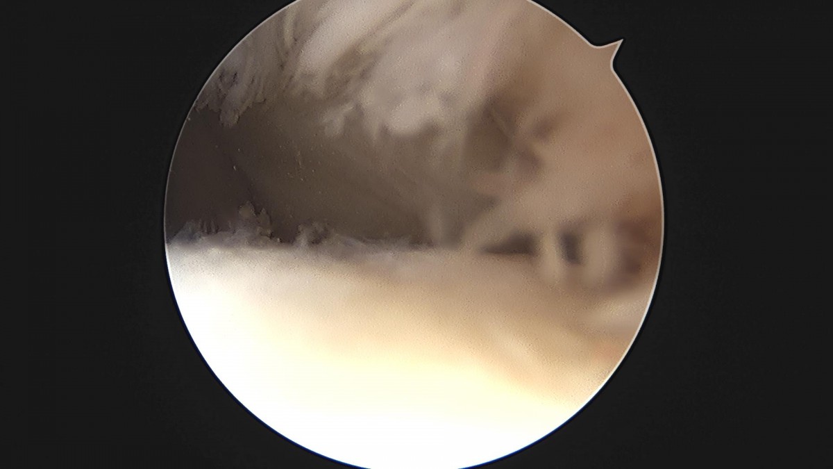 f69e1e55498c1bbac240a4e9eddb0040_1705375384_0641.jpg