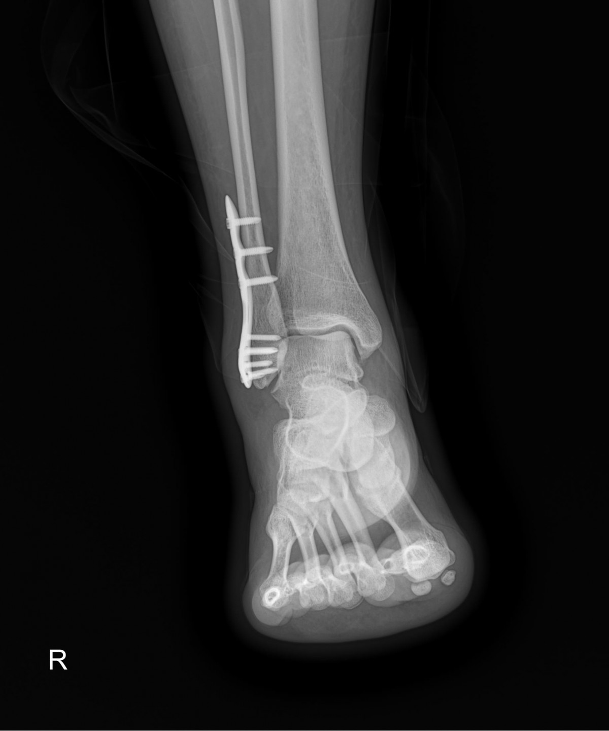 f537707b0b9f2537509492404de31ecf_1716862711_8381.jpg