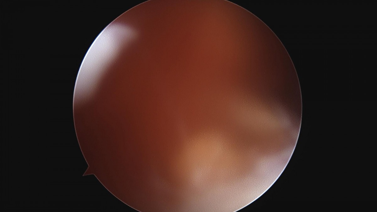 a5bb5aa2c868c534dc48e760e3eaf4b4_1720232789_6938.jpg