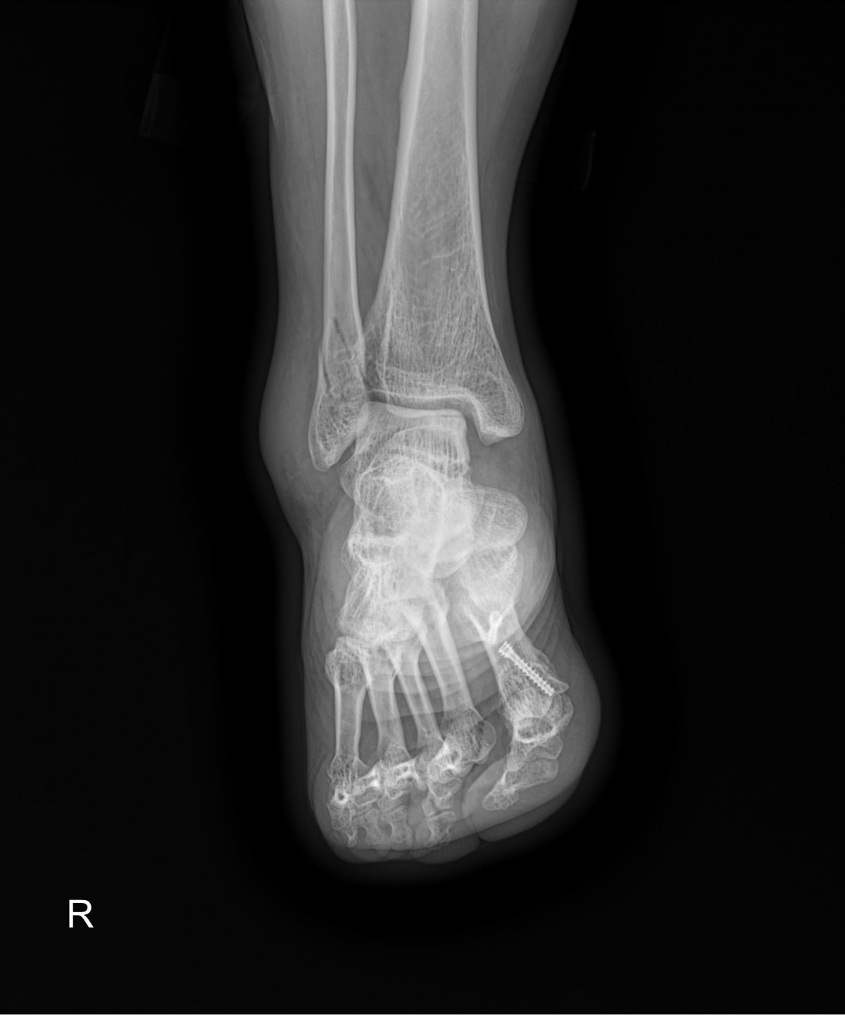 a5bb5aa2c868c534dc48e760e3eaf4b4_1720233678_076.jpg