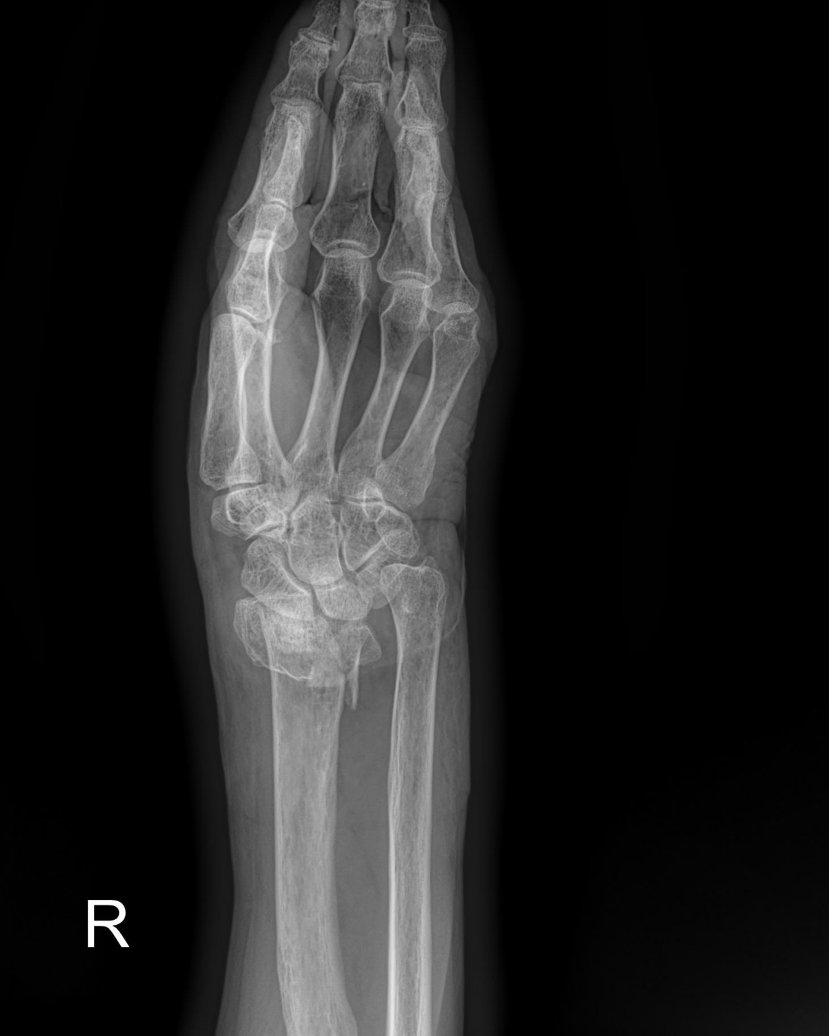 a5bb5aa2c868c534dc48e760e3eaf4b4_1720234627_0673.jpg
