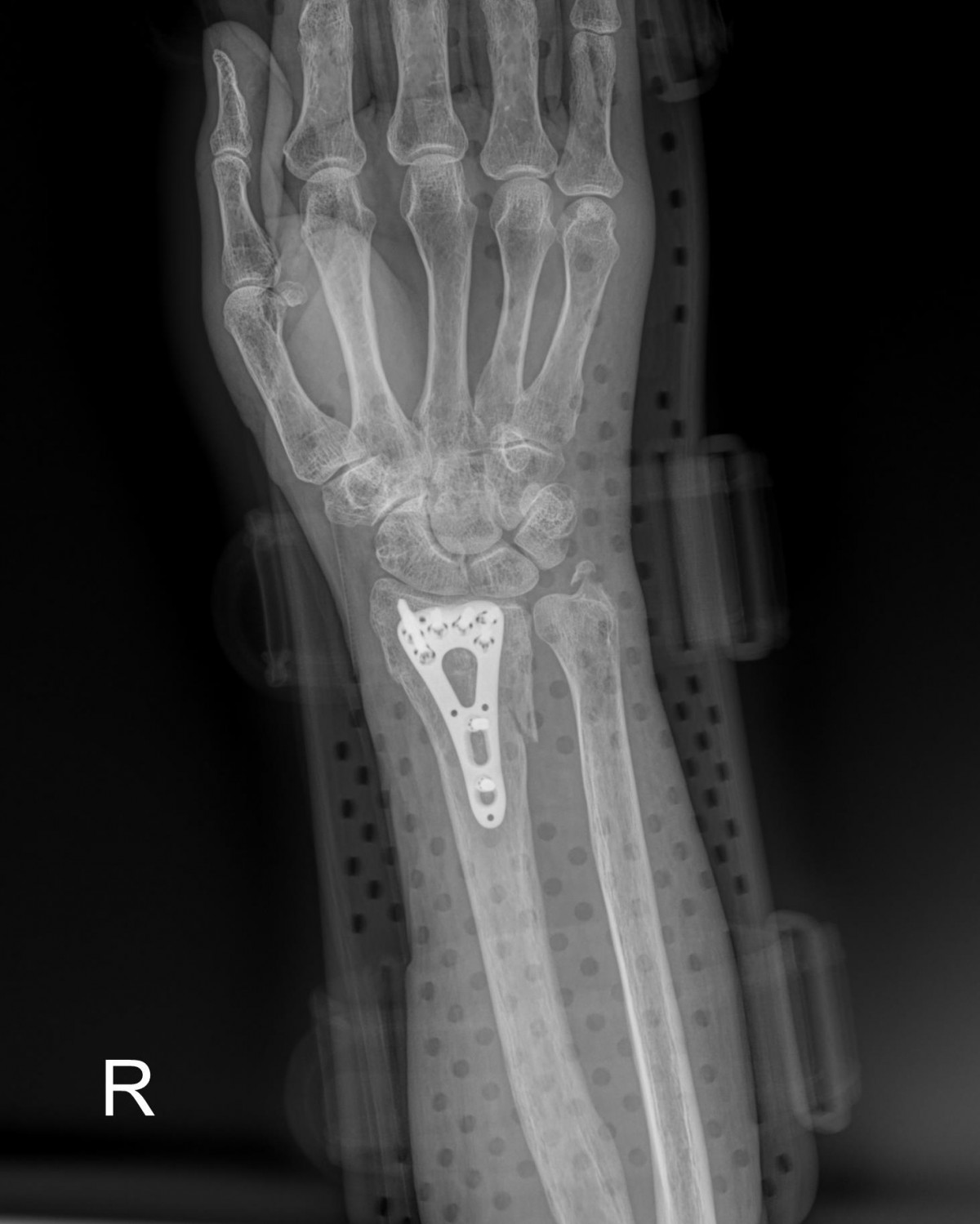 a5bb5aa2c868c534dc48e760e3eaf4b4_1720234637_7746.jpg